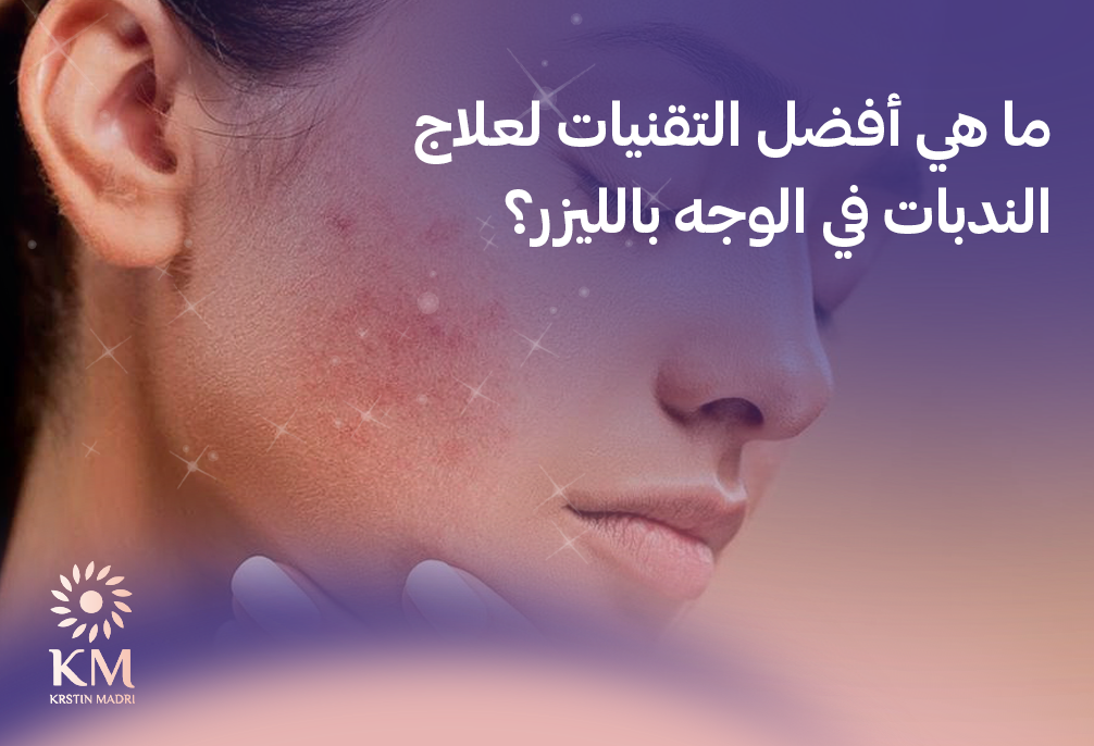 علاج الندبات في الوجه بالليزر