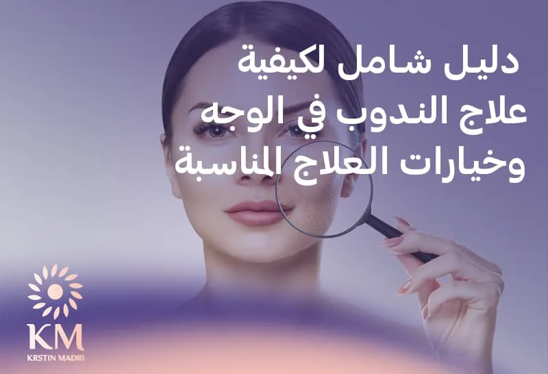 دليل شامل لكيفية علاج الندوب في الوجه وخيارات العلاج المناسبة