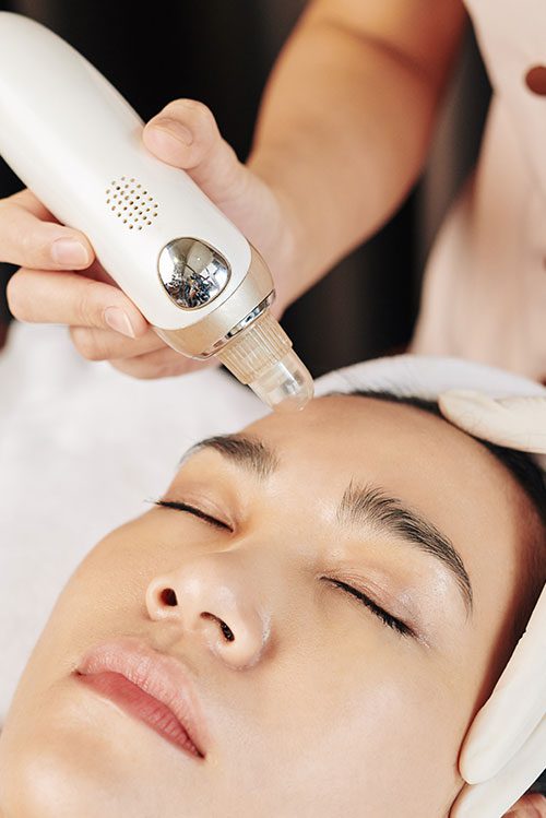 Das Ziel der Behandlung bestimmt, ob sich Hydrafacial oder Microneedling eignet.