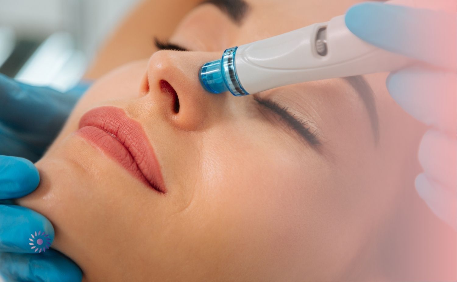 تجربتي مع الهيدرا فيشل