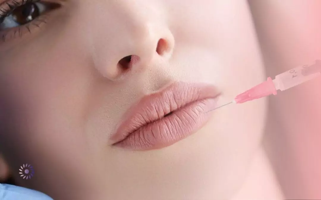 تجربتي مع بوتكس الابتسامة اللثوية مع دكتورة كرستين مدري في ألمانيا