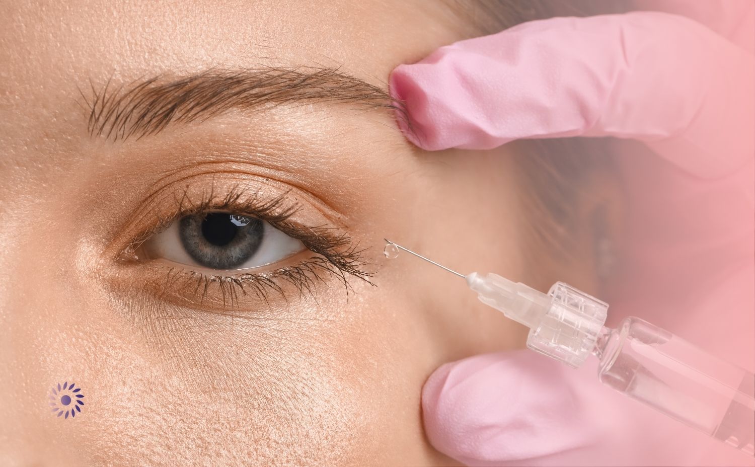 تجربتي مع حقن الفيلر تحت العين