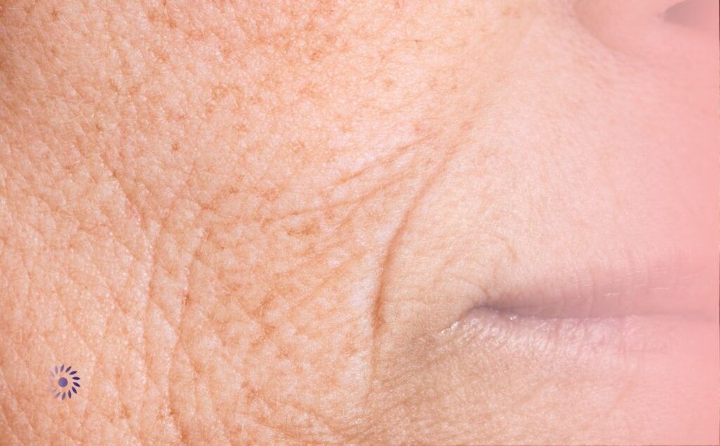 botox wuppertal elberfeld