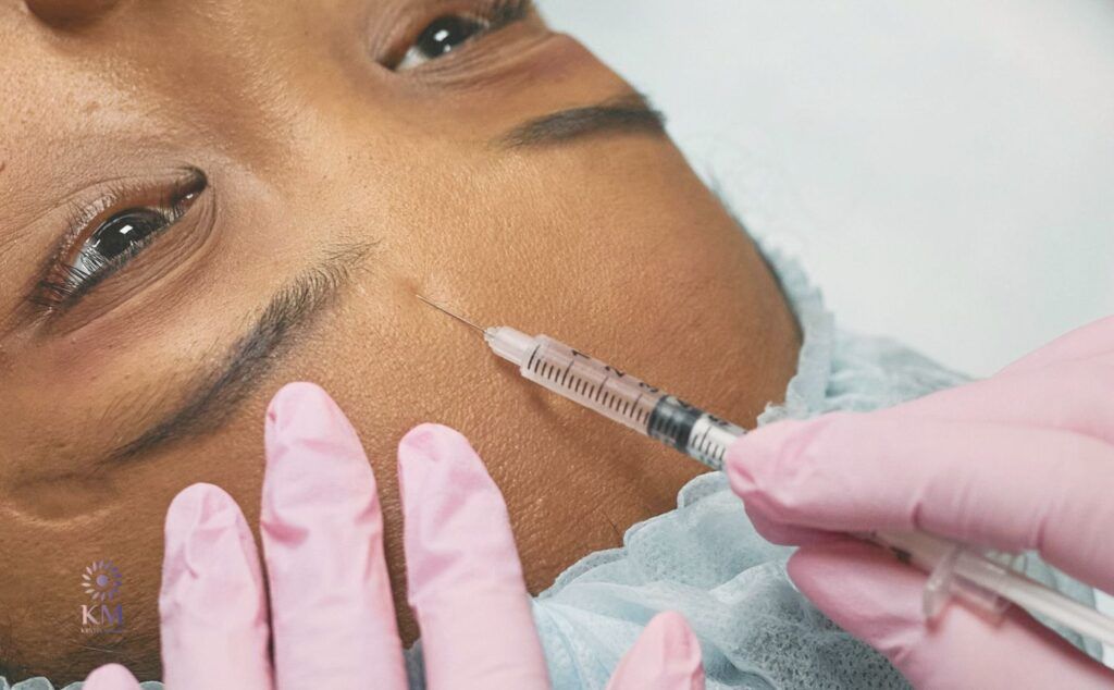 Wie läuft eine kombinierte Faltenbehandlung mit Hyaluron und Botox ab
