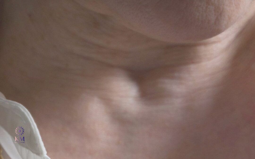 Halsfalten entfernen: Die effektivsten Methoden von Ihrer Expertin Krstin Madri