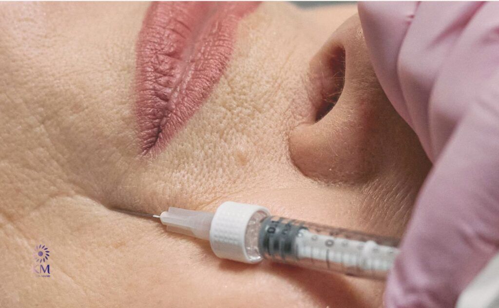 Welche Alternativen zur Faltenbehandlung mit Hyaluron und Botox gibt es