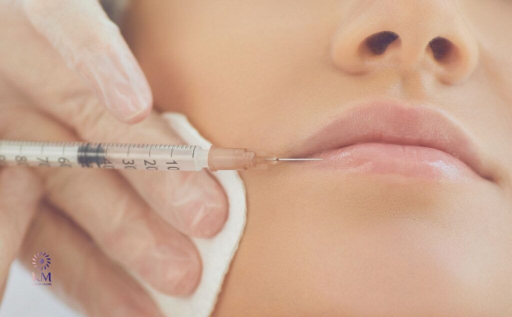 Wie lange hält die Wirkung von Botox und Hyaluron an?