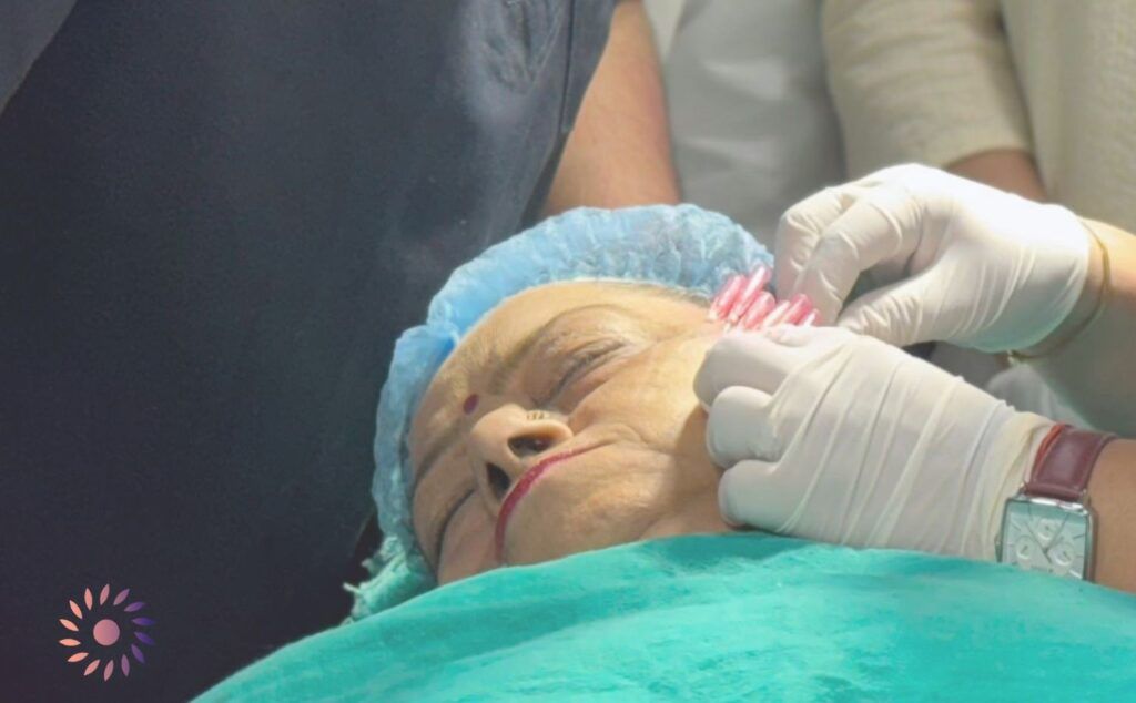 من هم المرشحون لحقن البلازما للوجه؟