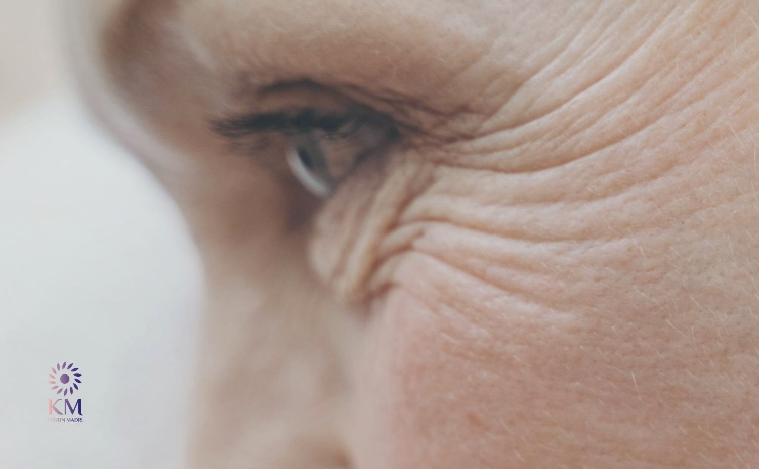 علاج الخطوط الرفيعة قبل أن تصبح تجاعيد عيادة كرستين مدري علاج الخطوط الرفيعة قبل أن تصبح تجاعيد عيادة كرستين مدري