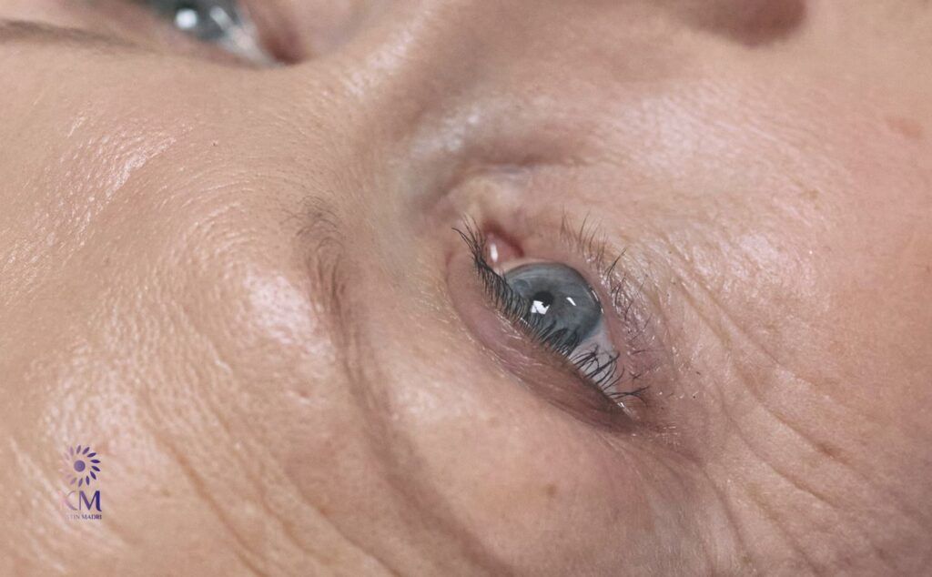 كيف يمكنني تأخير ظهور التجاعيد والحفاظ على شباب بشرتي؟