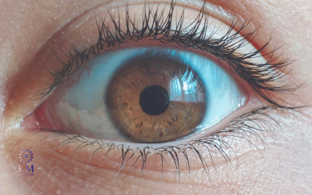 Dunkle Augenringe entfernen mit Hyaluronsäure: Ihr wacher Blick in Wuppertal