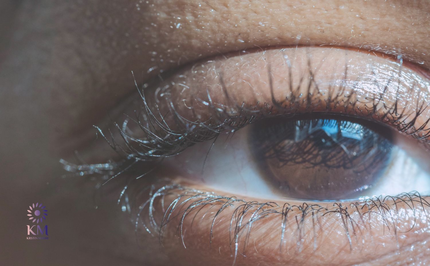 الفرق بين شد الجفون العلوية والسفلية عيادة الدكتورة كرستين مدري