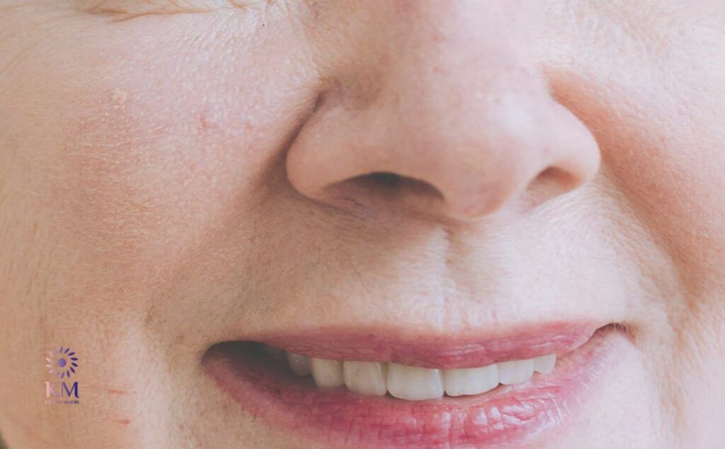 كيف يعمل الفيلر كأفضل حل لملء التجاعيد الأنفية الشفوية؟