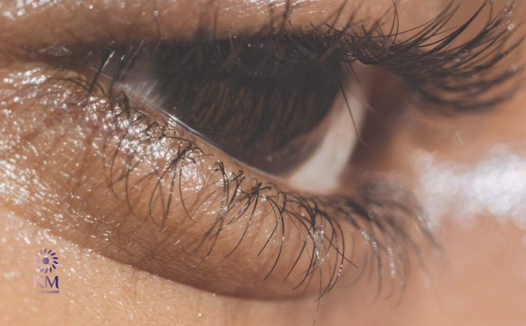 ما هي أضرار عمليات شد الجفون العلوية والسفلية الجراحية؟