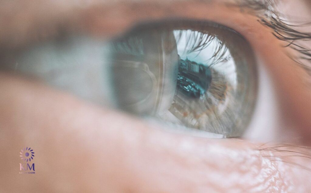 ما هي اسباب الزوائد الجلدية تحت العين؟