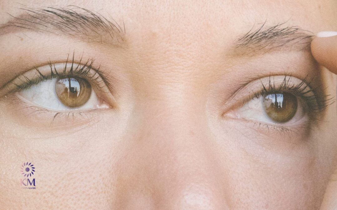 التخلص من ترهل الجفون نهائياً | عيادة الدكتورة كرستين مدري