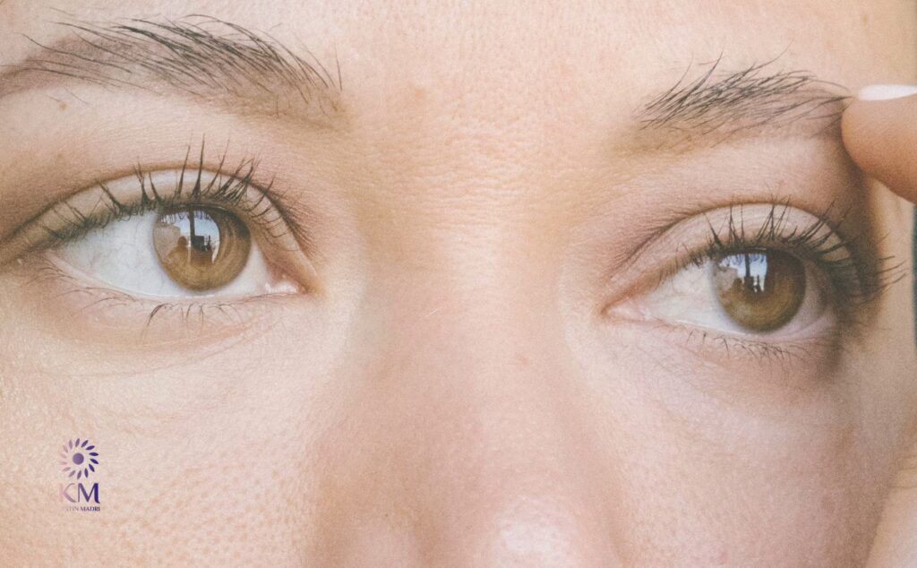 ما هي خطوات التخلص من ترهل الجفون نهائياً مع الدكتورة كرستين مدري؟