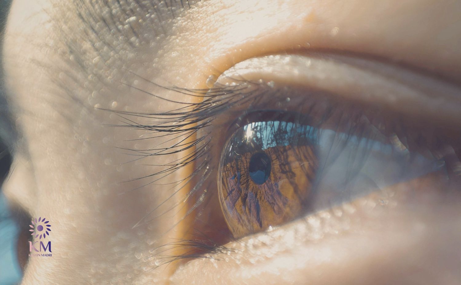 الفرق بين شد الجفون السفلية بالليزر والجراحة كرستين مدري الفرق بين شد الجفون السفلية بالليزر والجراحة كرستين مدري