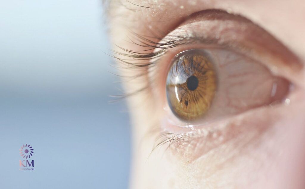 ما هي أسباب ترهل الجفون السفلية تحت العين؟