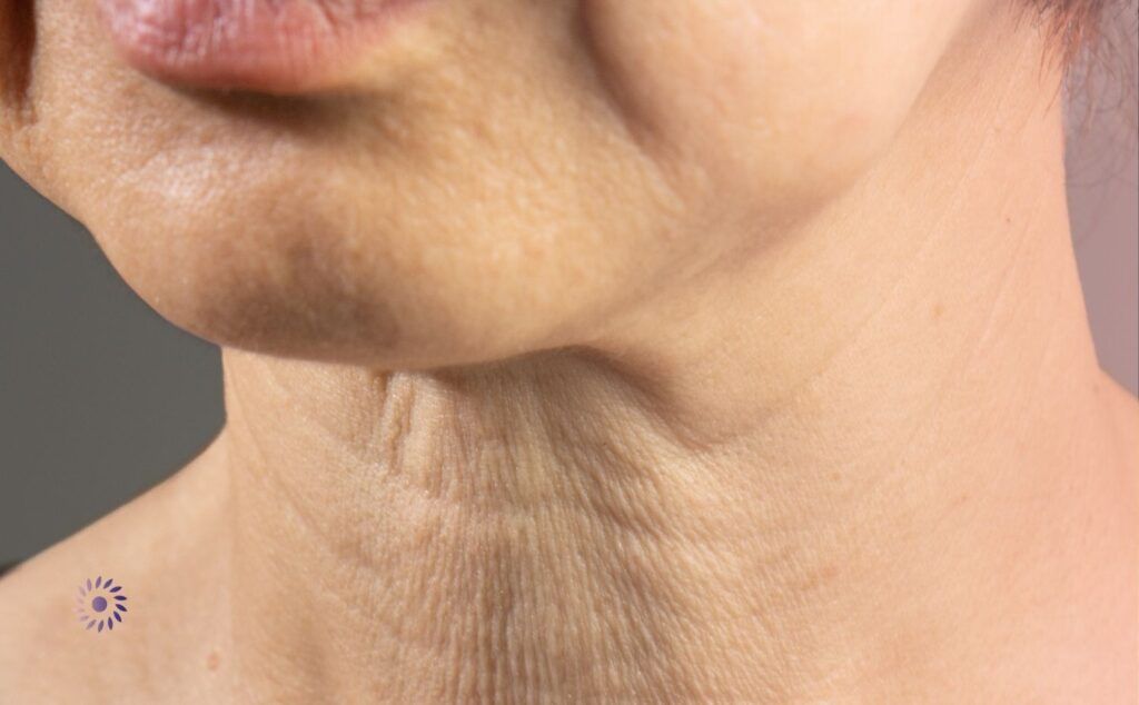 Wie läuft die Behandlung der Hängebäckchen ab